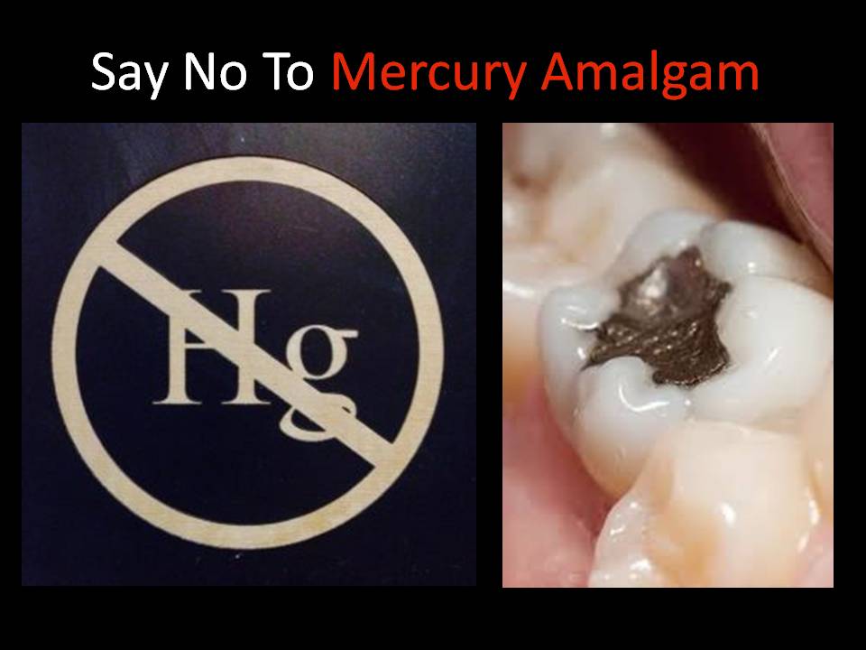 Momentum builds to end the largest mercury use in U.S.A. – dental amalgam