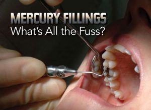 Mercury in Dentistry Risk to Human & Environment